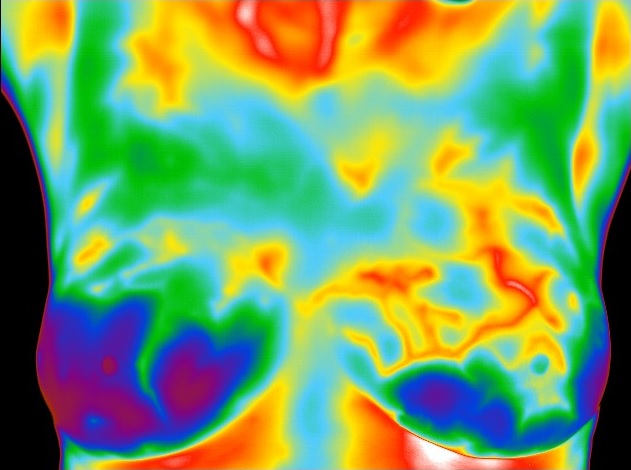 Image TH4